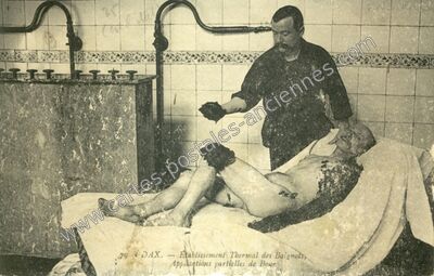Carte postale ancienne Établissement Thermal des Baignots, Applications partielles de Boue — Dax (Landes)